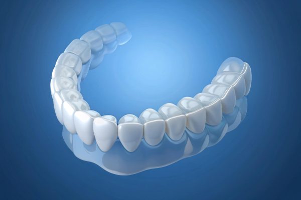 Invisalign czy zwykły aparat