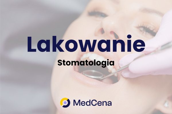 Lakowanie