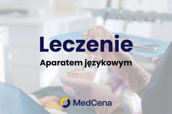 Leczenie aparatem językowym