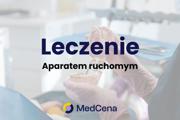 Leczenie aparatem ruchomym