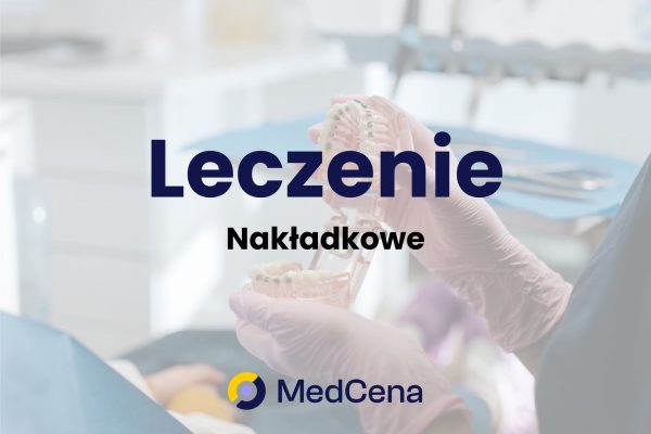 Leczenie nakładkowe