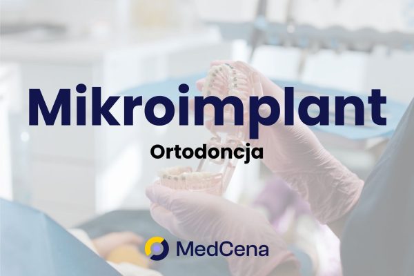 Mikroimplant