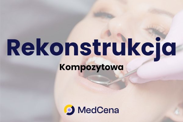Rekonstrukcja kompozytowa