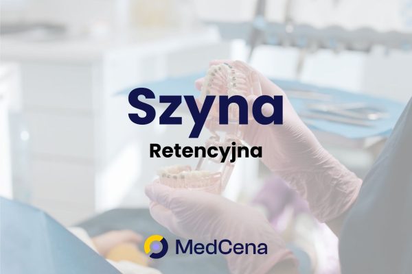Szyna recencyjna