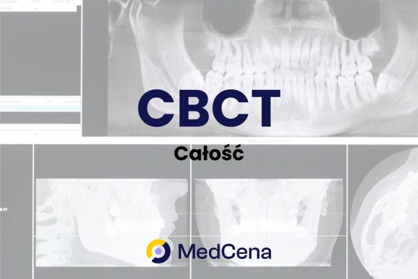 CBCT całość