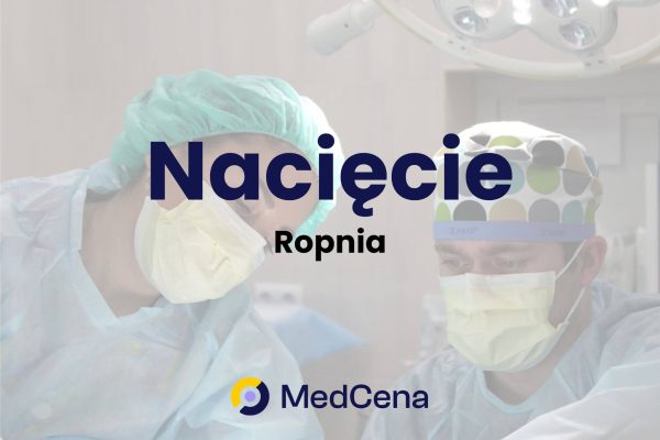 Nacięcie ropnia