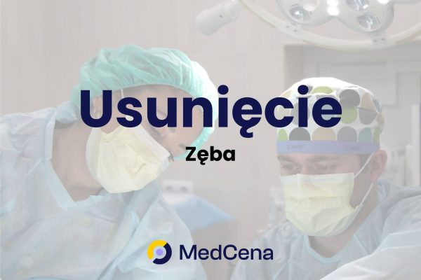 Usunięcie zęba