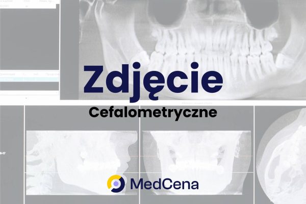 Zdjęcie cefalometryczne