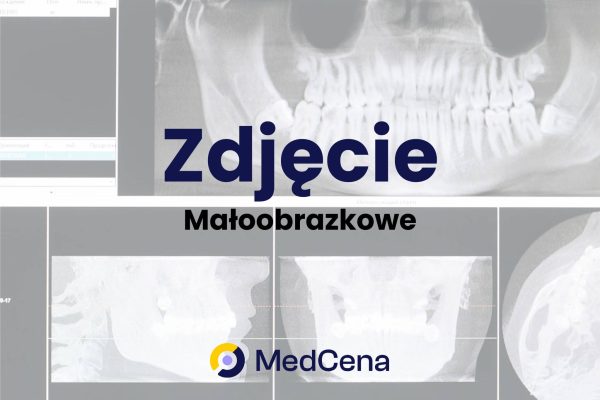 Zdjęcie małoobrazkowe