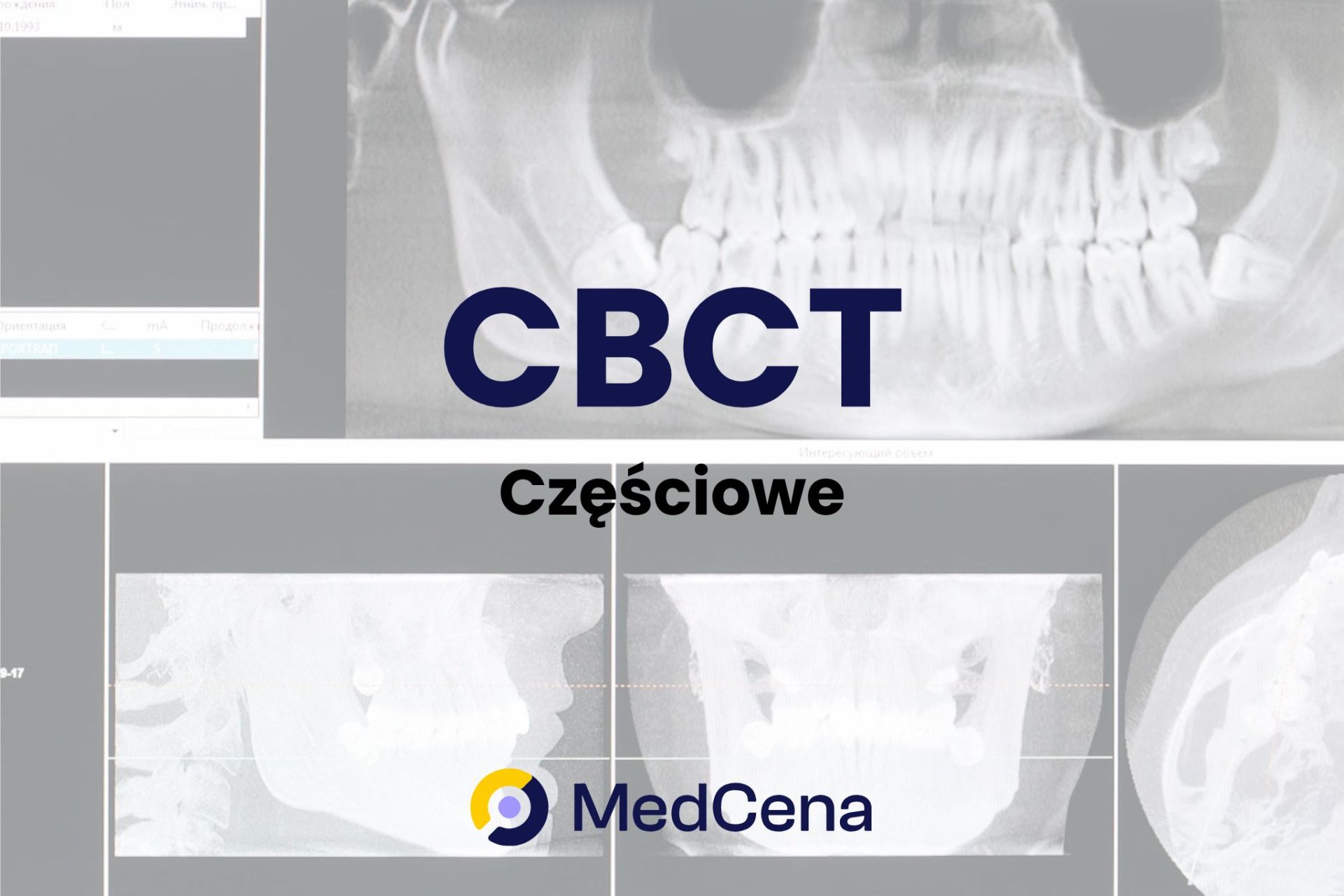 CBCT częściowe – jak przebiega? Opis zabiegu [radiologia]