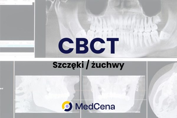 CBCT szczęki żuchwy