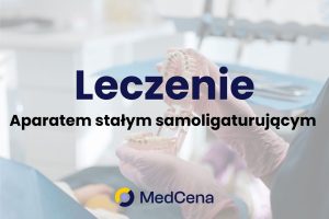 Leczenie aparatem stałym samoligaturującym