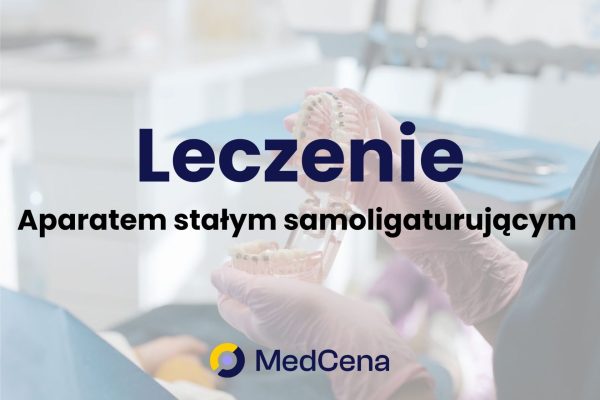Leczenie aparatem stałym samoligaturującym