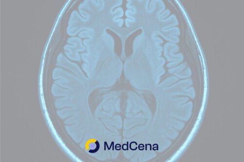 Umieranie na glejaka – forum, pierwsze objawy glejaka