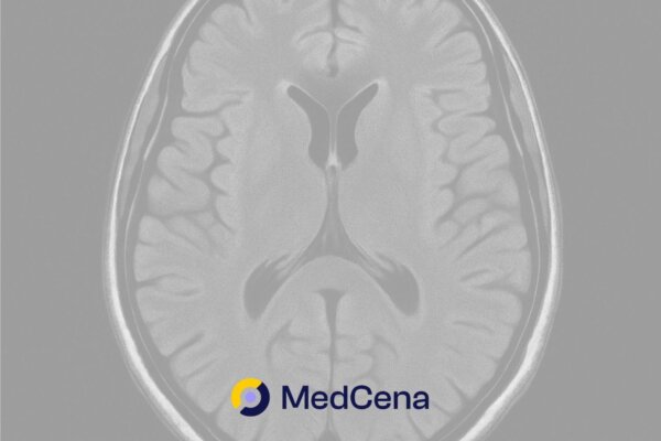 Guz mózgu – forum, pierwsze objawy guza mózgu