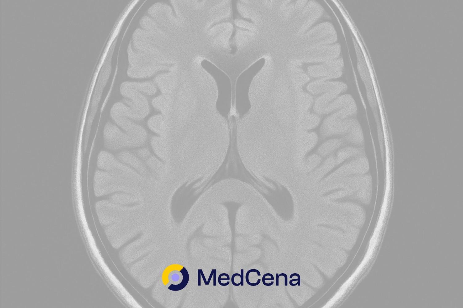 Guz mózgu – forum, pierwsze objawy guza mózgu