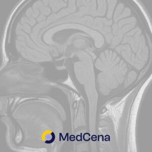 Jak się umiera na guza mózgu? Objawy przed śmiercią