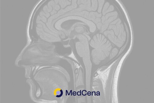Jak się umiera na guza mózgu? Objawy przed śmiercią