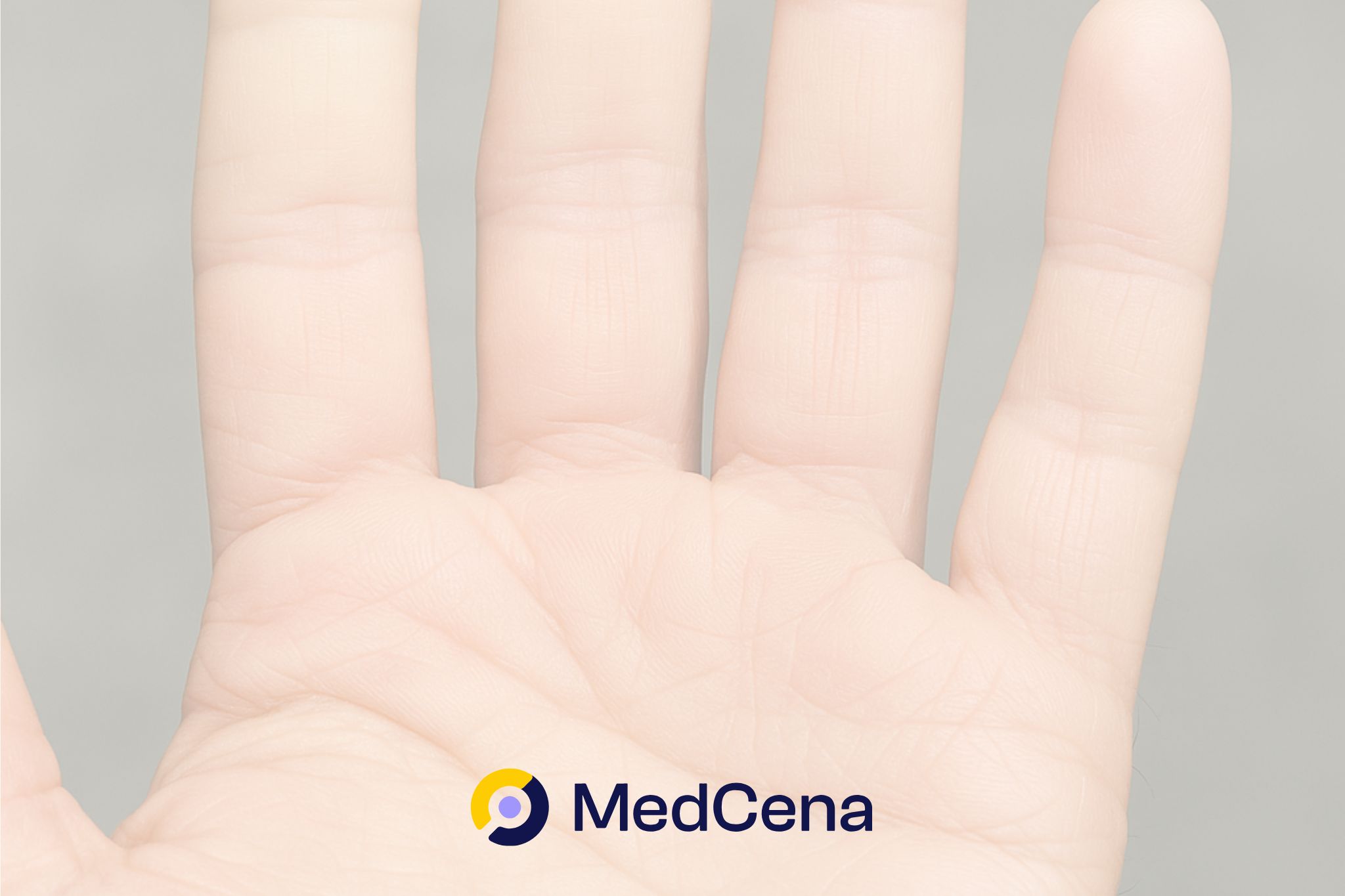 Twardzina układowa forum – leczenie sklerodermii [2025]